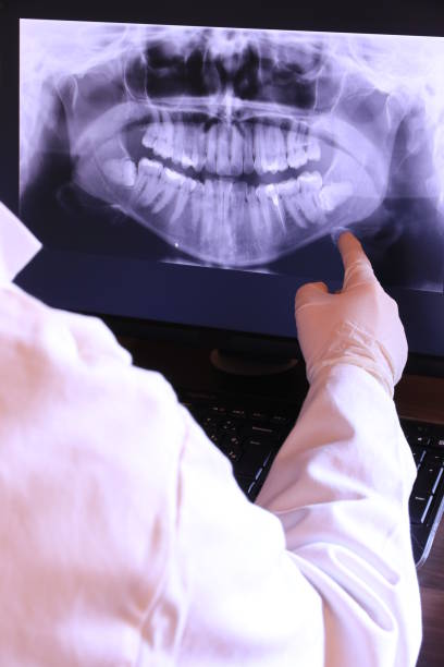Best Emergency Dental Extractions in Dolton, IL