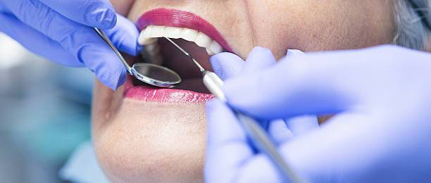 Best Broken or Cracked Tooth Emergency Dentist in Dolton, IL